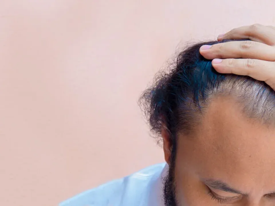 Does Amlodipine Cause Hair Loss