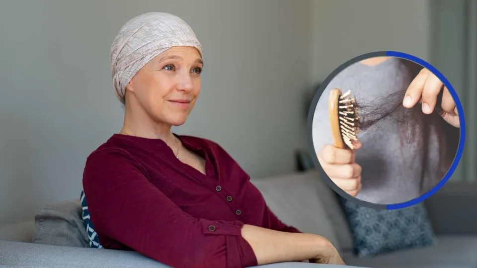 Does Cancer Cause Hair Loss Facts To Know After SYBIL